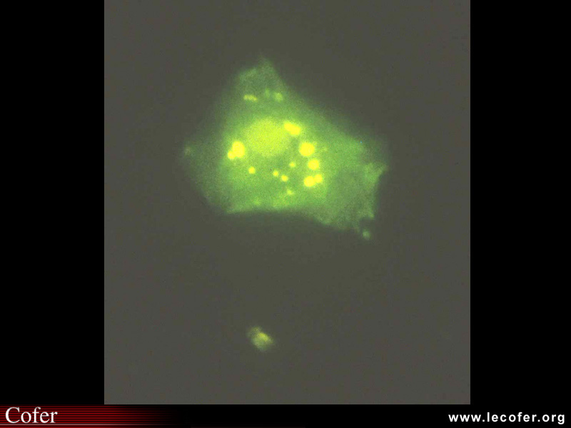 Anticorps anti-périnucléaires, APN immunofluorescence