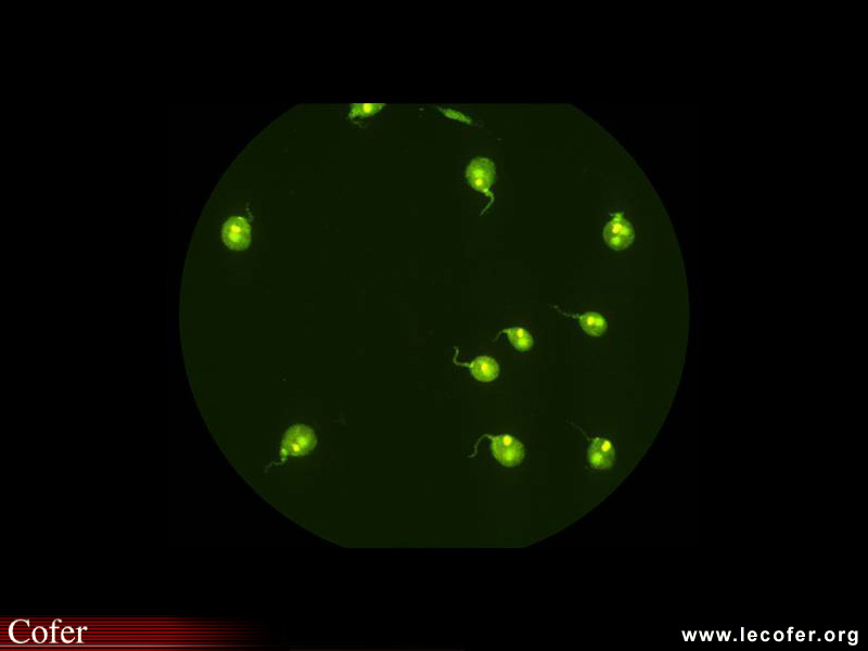 Lupus systémique, lupus érythémateux disséminé : anomalies immunologiques au cours du lupus systémique