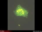 Anticorps anti-périnucléaires, APN immunofluorescence
