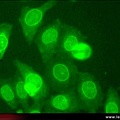 Anticorps AntiNucléaires : AAN sur Hep-2 : AAN périphérique immunofluorescence