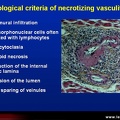 Vascularites, critères anatomo-pathologiques des vascularites nécrosantes